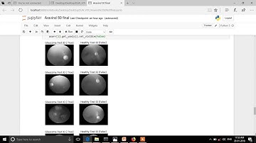 Automated Detection of Glaucoma using Deep Neural Network