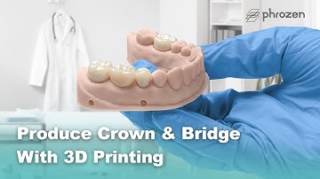 How to Produce Crown & Bridge with 3D Printing - Phrozen Dental 3D Printer