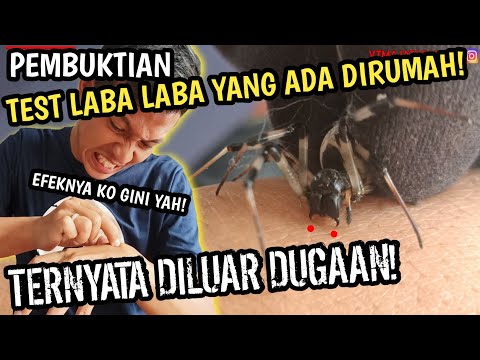 GIGITAN LABA LABA BERACUN!? KENALI JENIS LABA LABA DISEKITAR KITA! EREUP EREUP