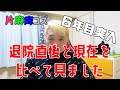 Vol175 片麻痺コズ6年目突入　退院直後と現在を比べて見ました