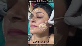 BB glow treatment at AWISH Clinic | Best Glowing Treatment #awishclinic #bbglow #glowingface #shorts