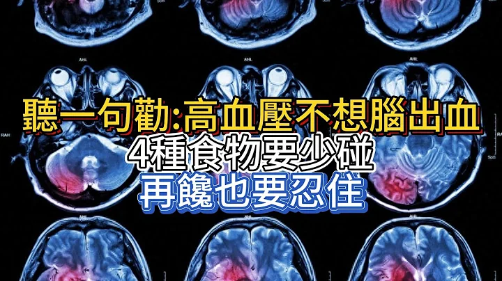 听一句劝：高血压不想脑出血，4种食物要少碰，再馋也要忍住 - 天天要闻