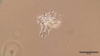 Amoeba phase contrast, 4x speed