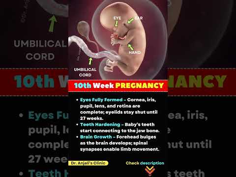 10 Week Pregnancy