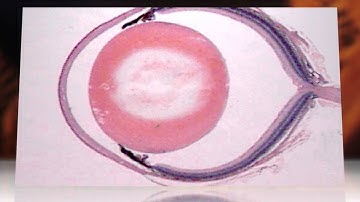 Researchers Create Bionic Prosthetic Retina That Could Help the Blind See