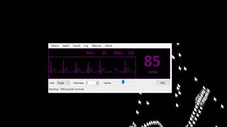 (New Series): 1.5 hrs LIVE Female Heartbeat w/Breathing/stomach Sounds ASMR w/EKG, Episode 2