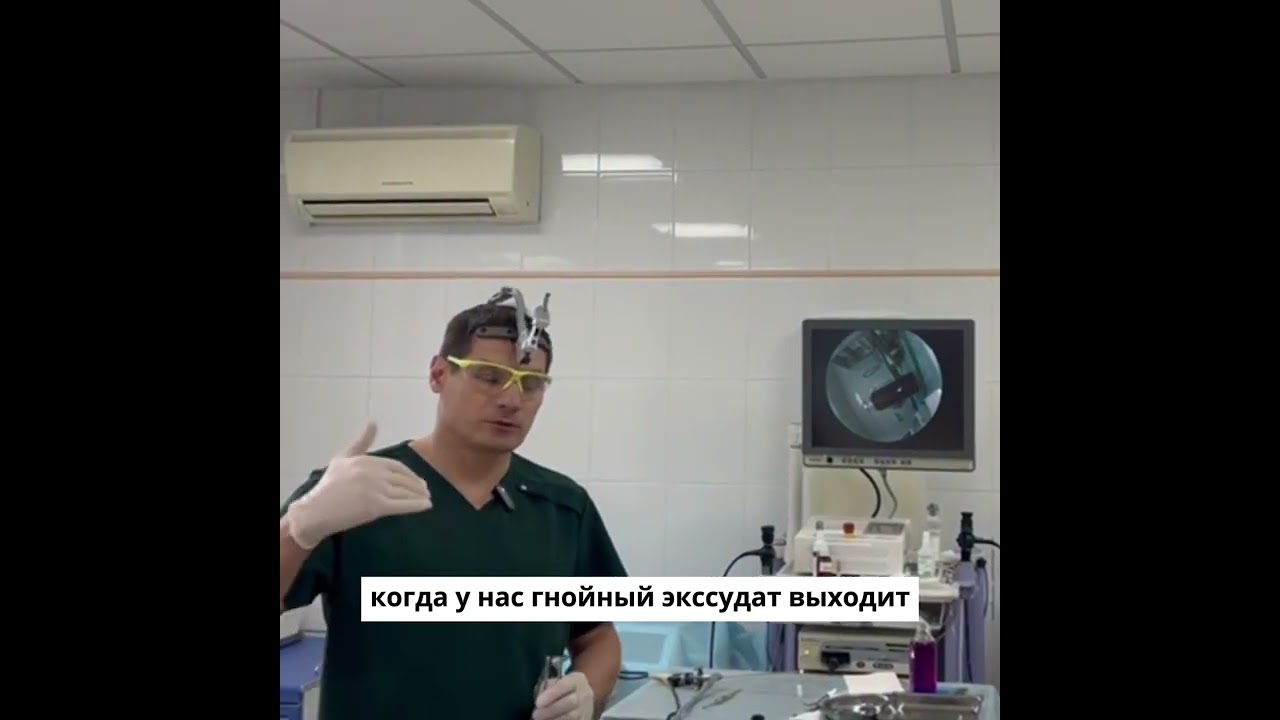 Лечение гайморита при беременности.Зондирование пазух носа.