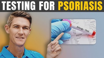 What Testing to get for Psoriasis | How to know why you have Psoriasis