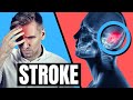 Did you have a STROKE? - F.A.S.T.  Explained - Symptoms, Treatment and Prevention