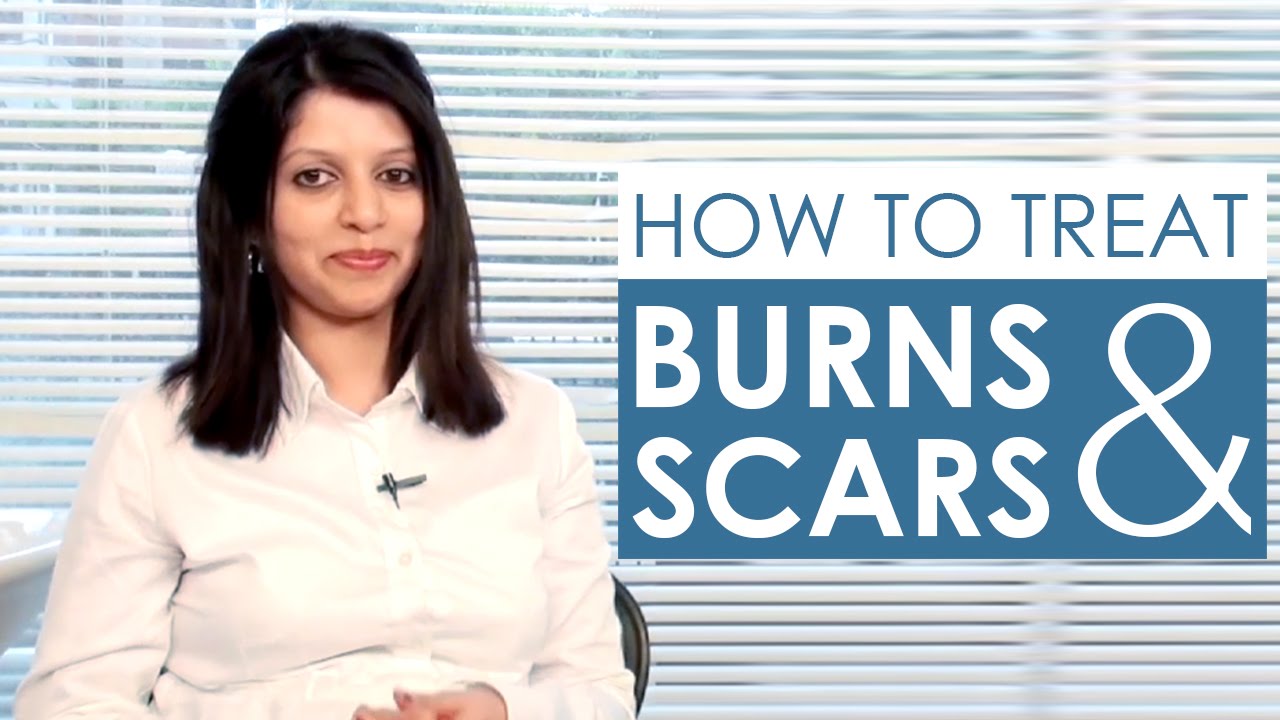 How to Treat Burns and Scars 