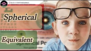 WHY DO WE DO Spherical Equivalent | 2 methods to find S.E| What is Circle of least confusion |