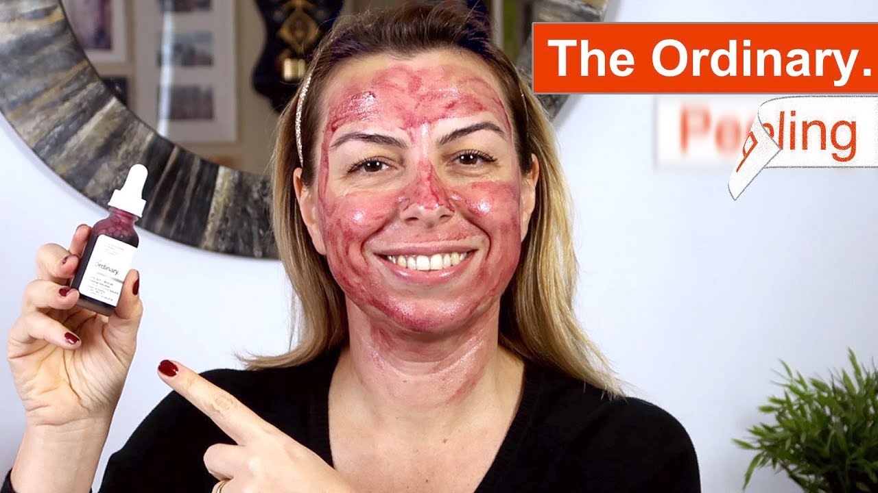 KİMYASAL PEELING | THE ORDINARY AHA 30% + BHA 2% Peeling Solution