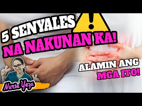 Video: Pagbubuntis Sa Pagkawala (Pagkalaglag) Sa Chinchillas