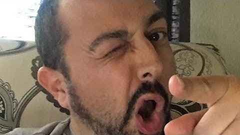 Ask random clinical trial questions live! (SAS, data analysis questions)