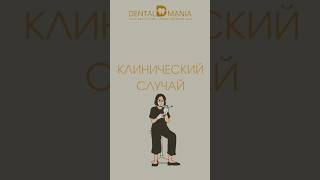 В этом видео наш врач-ортодонт,к.м.н. Крылова И.В. разберет  один интересный клинический случай