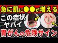 【知らずに後悔】絶対に見逃さないで！胃がんが隠れている意外な症状5選