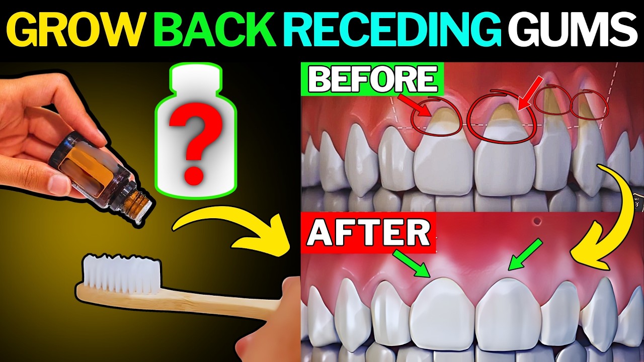 Outline Video How to Regrow Receding Gums Fast Naturally