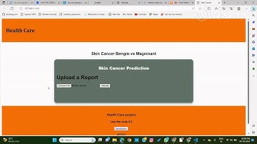 Skin Cancer Detection Project