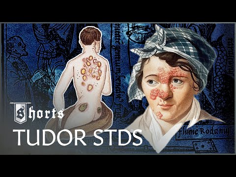 ⁣The Deadly Tudor Syphilis Outbreak #Shorts