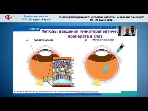 Шурыгина М.Ф. - Генная терапия наследственных дистрофий сетчатки.  Российские разработки