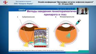 Шурыгина М.Ф. - Генная терапия наследственных дистрофий сетчатки.  Российские разработки