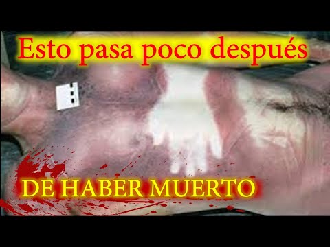 Rigor mortis y livor mortis: todo lo que necesitas saber