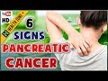 6 Early Signs of Pancreatic Cancer | Symptom of Pancreatic Cancer