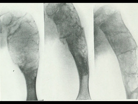 explore-alternatives-before-opting-for-orthopedic-surgery