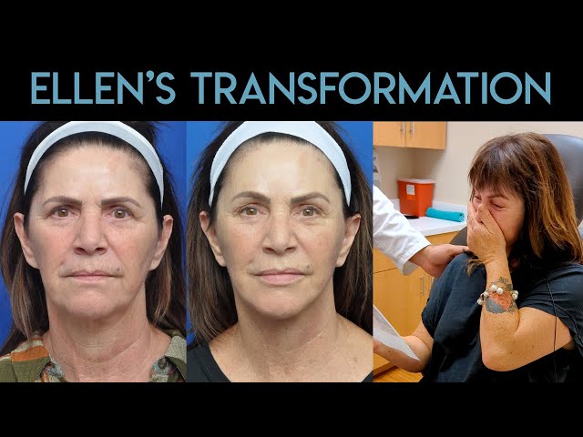 Ellen's Transformation