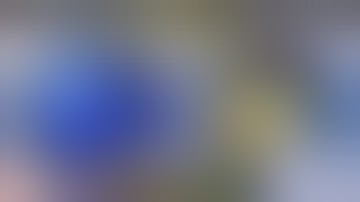 Tough Case: Small Pupil, PFX,Shallow Anterior Chamber- Strategies to follow -  BHEX- Dr Deepak Megur