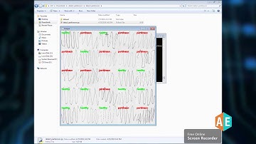 Early Detection of Parkinson Disease | Final Year Project