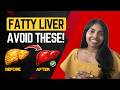 REVERSE Fatty Liver with These Tips! #dietitiantips #healthylifestyle