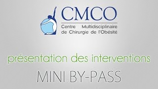 CMCO - Vidéo de présentation du Mini By-Pass