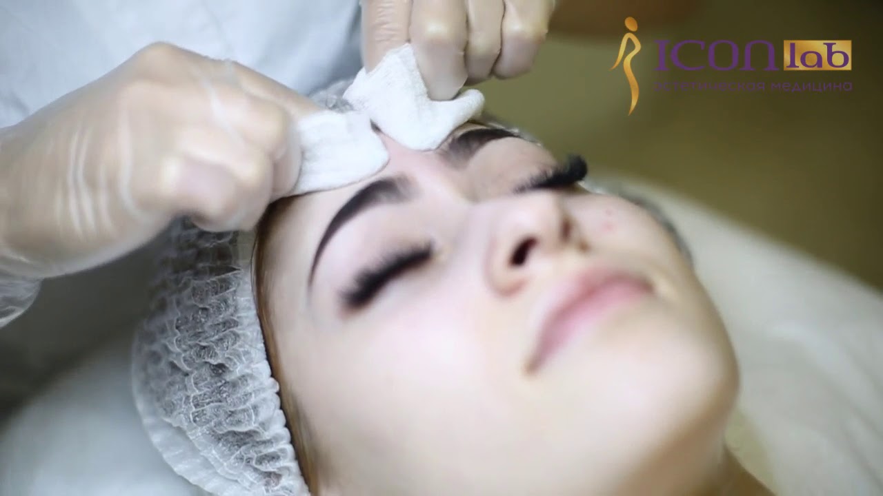 Мануальная чистка лица - YouTube