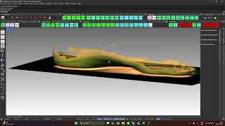 Mediaal gewelf manipuleren hoogte en lengte (20251231)