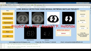 Lung Nodule Detection On Dicom Image Using Neural Network | With Source Code | Matlab Project Code
