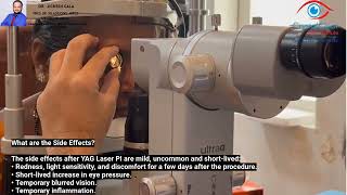YAG laser Peripheral Iridotomy by DR Jignesh Gala, @crystalcleareyehospital Andheri west 7718885245