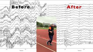 AI EEG signal reconstruction