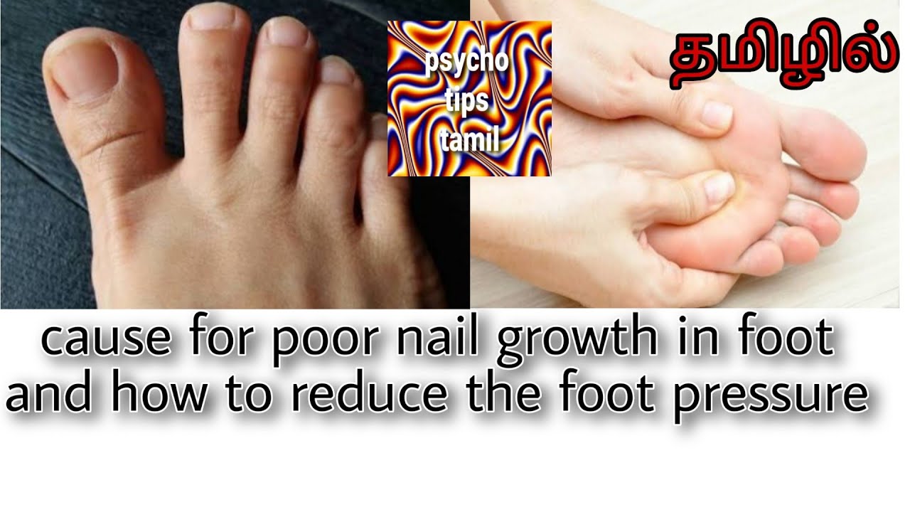 Reason for Poor Nail Growth in Foot How to Reduce the Foot Pressure in Tamil by psycho tips