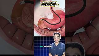 Prosedur ERCP