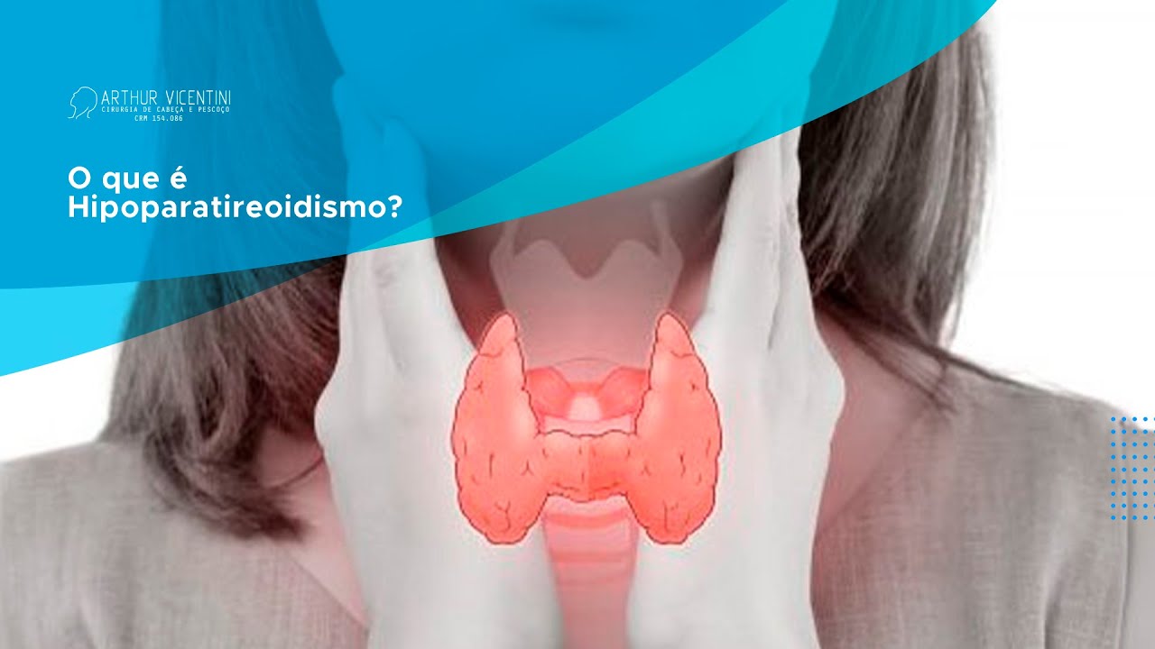 O Que é Hipoparatireoidismo - FDPLEARN