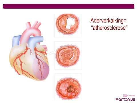 Hartrevalidatie - meer over het hart