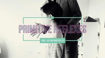 Testing for a persistent TONIC LABYRINTHINE REFLEX (TLR)