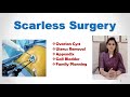 Scarless surgery  ovarian cyst uterus removal  sils  drdeepa ganesh  cosmetic gynecologist