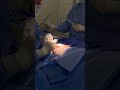 RUPTURED SILICONE IMPLANT