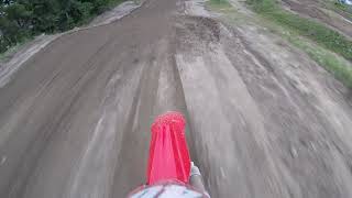 Mx101