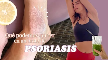 ¿Cómo detener los brotes de psoriasis?