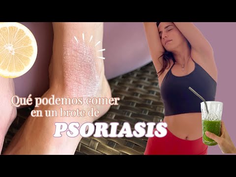 Video: Cómo seguir la dieta adecuada para la psoriasis: 15 pasos