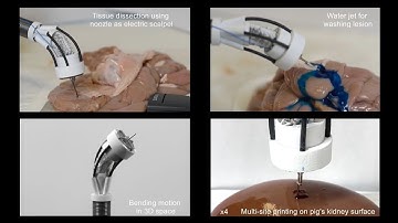 New robot can 3D bioprint inside human body