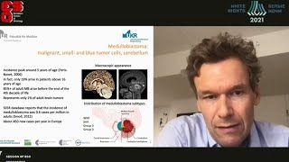 Medulloblastoma in adults